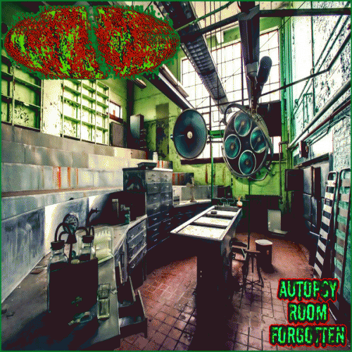 Estenosis Aortica : Autopsy Room Forgotten